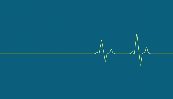 heart rate illustration digital art minimalism simple background 2k